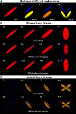 Diffusional Kurtosis Imaging in the Diffusion Imaging in Python Project